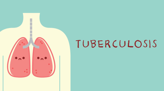 Tuberkulosis TBC Dapat Mempengaruhi Kemampuan Pikiran Penderitanya