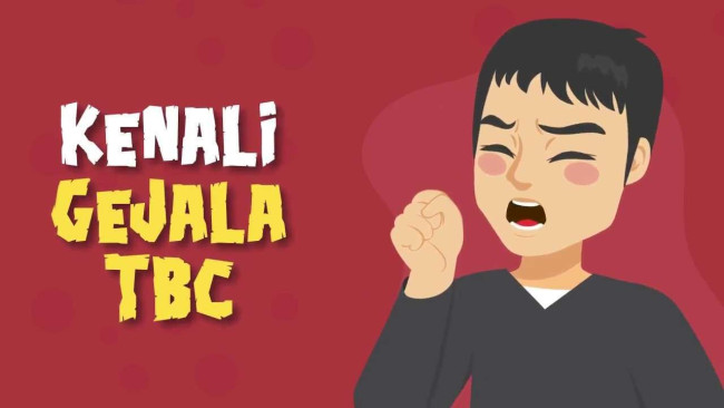 kenali gejala tbc
